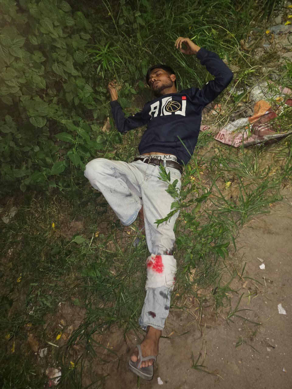 गाजियाबाद में चेन स्नैचर से पुलिस की मुठभेड़, पैर में लगी गोली; साथी फरार 1 WhatsApp Image 2026 09 21 at 11.36.19 PM
